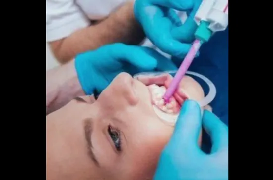 자동 혼합 팁이 포함된 치과용 인상재